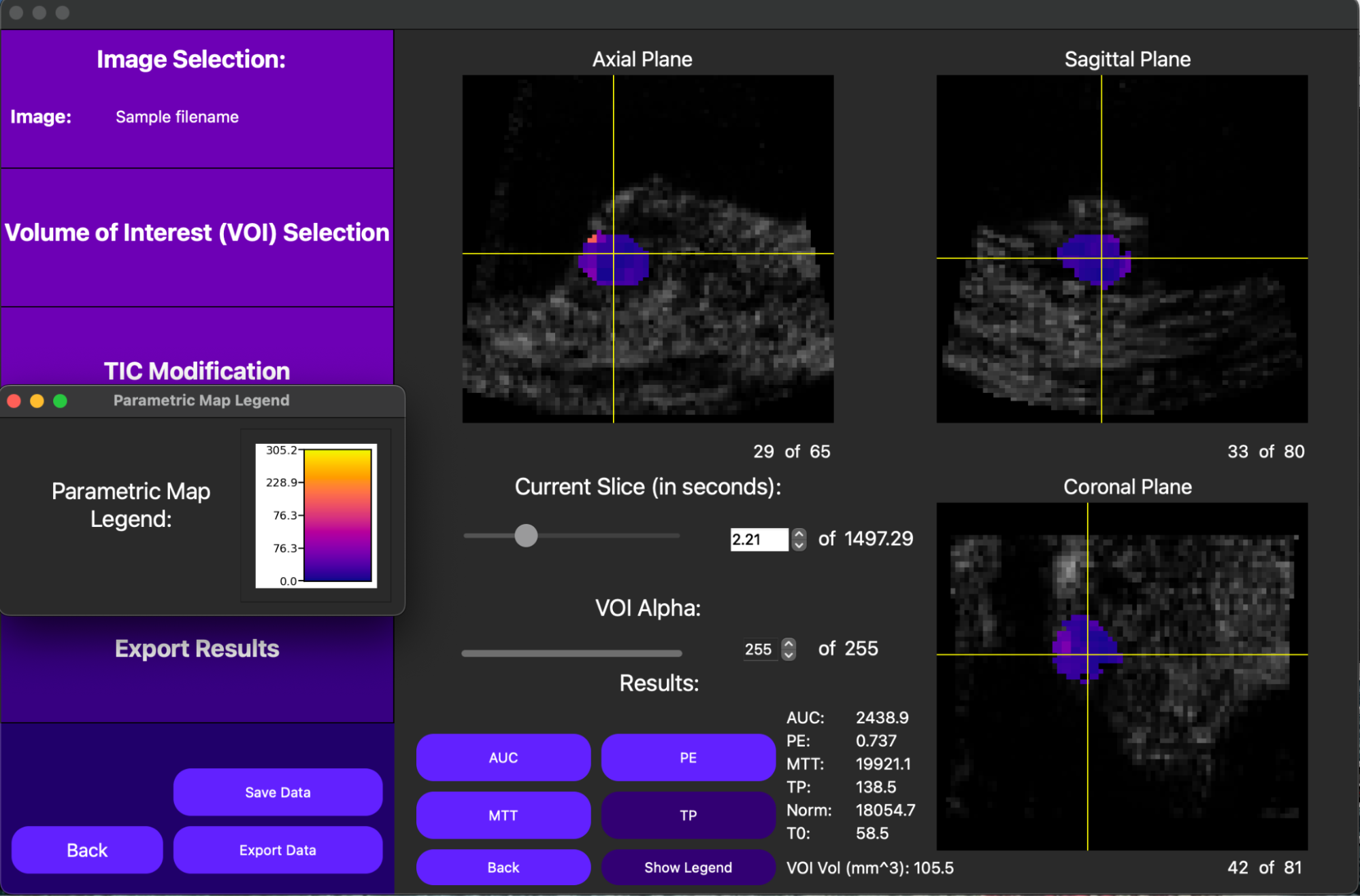 3D DCE-US Parametric Map Example