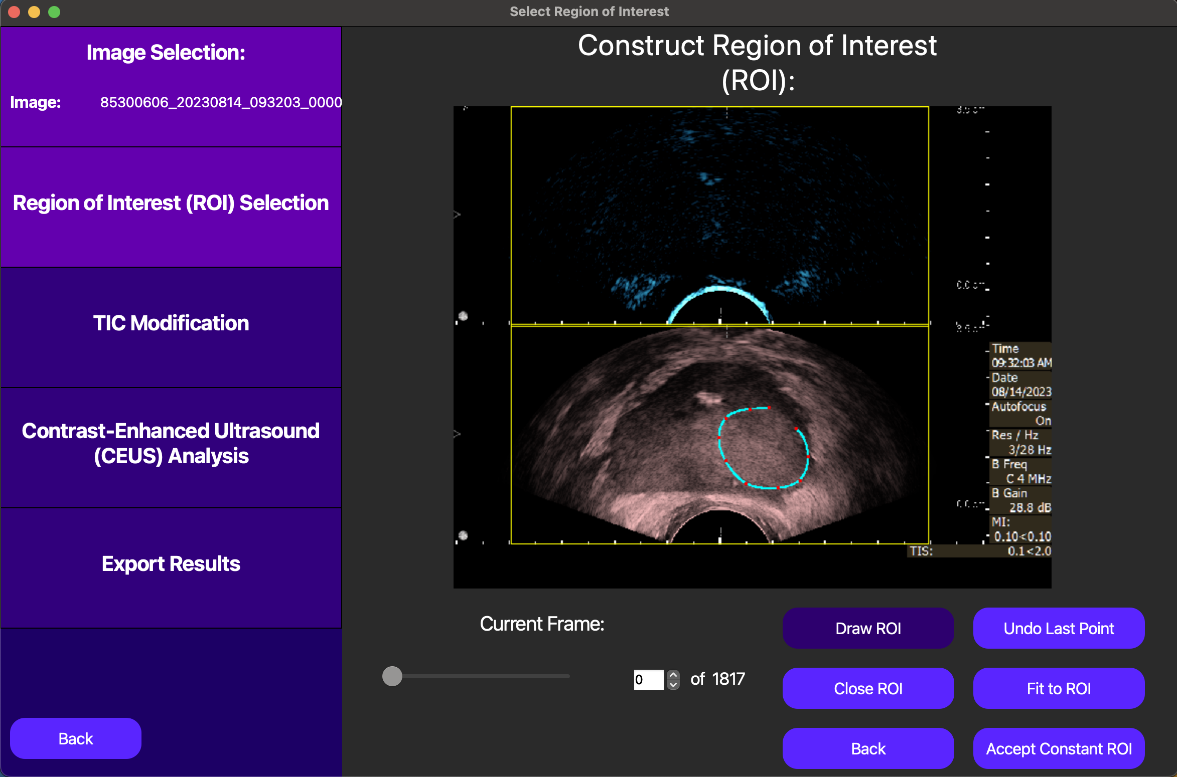 Drawing ROI on GUI